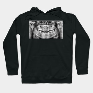 X-Ray Hoodie